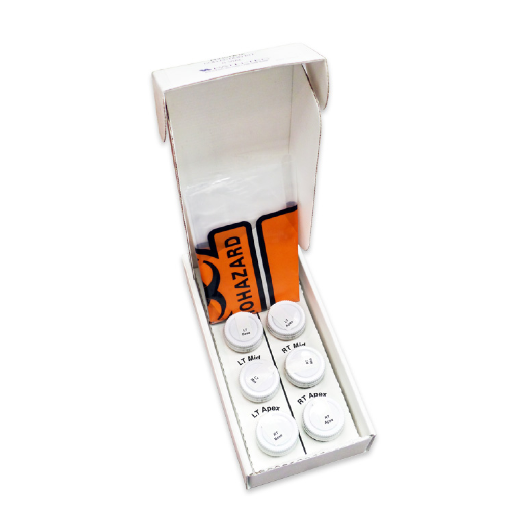 Prostate Collection Kit Standard 6 Vial