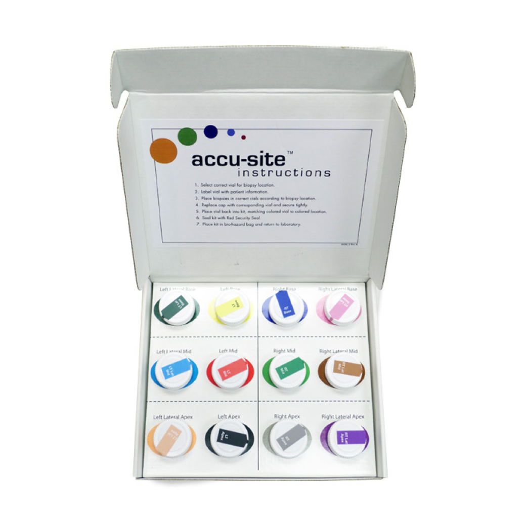 Prostate specimen Collection Kit